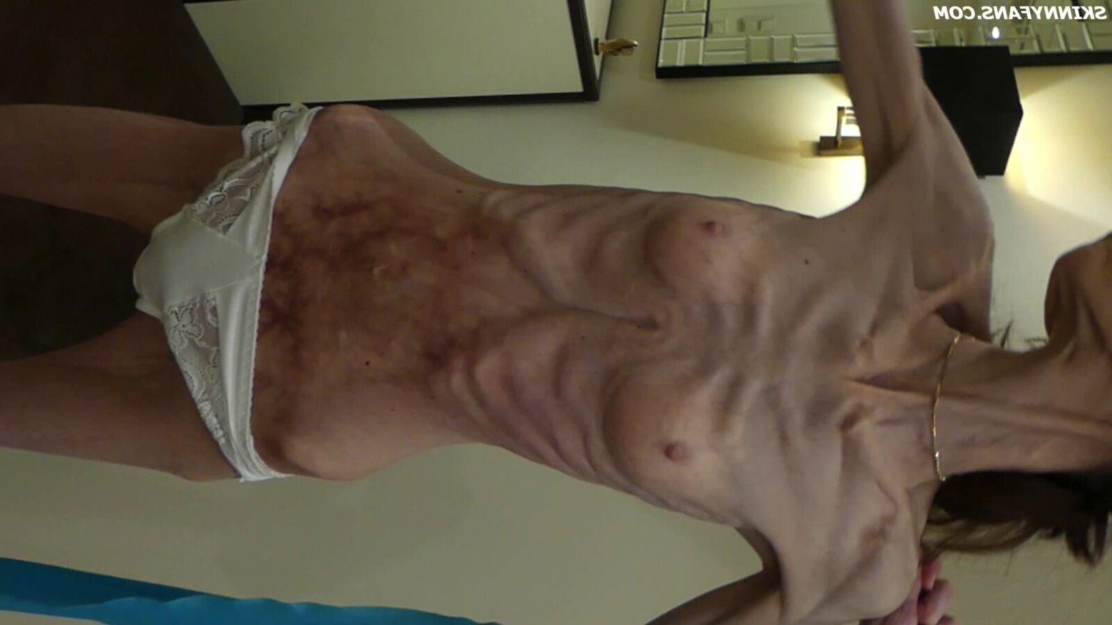Gina anoréxica skinny frágil Mager Duenn Knochig Bones