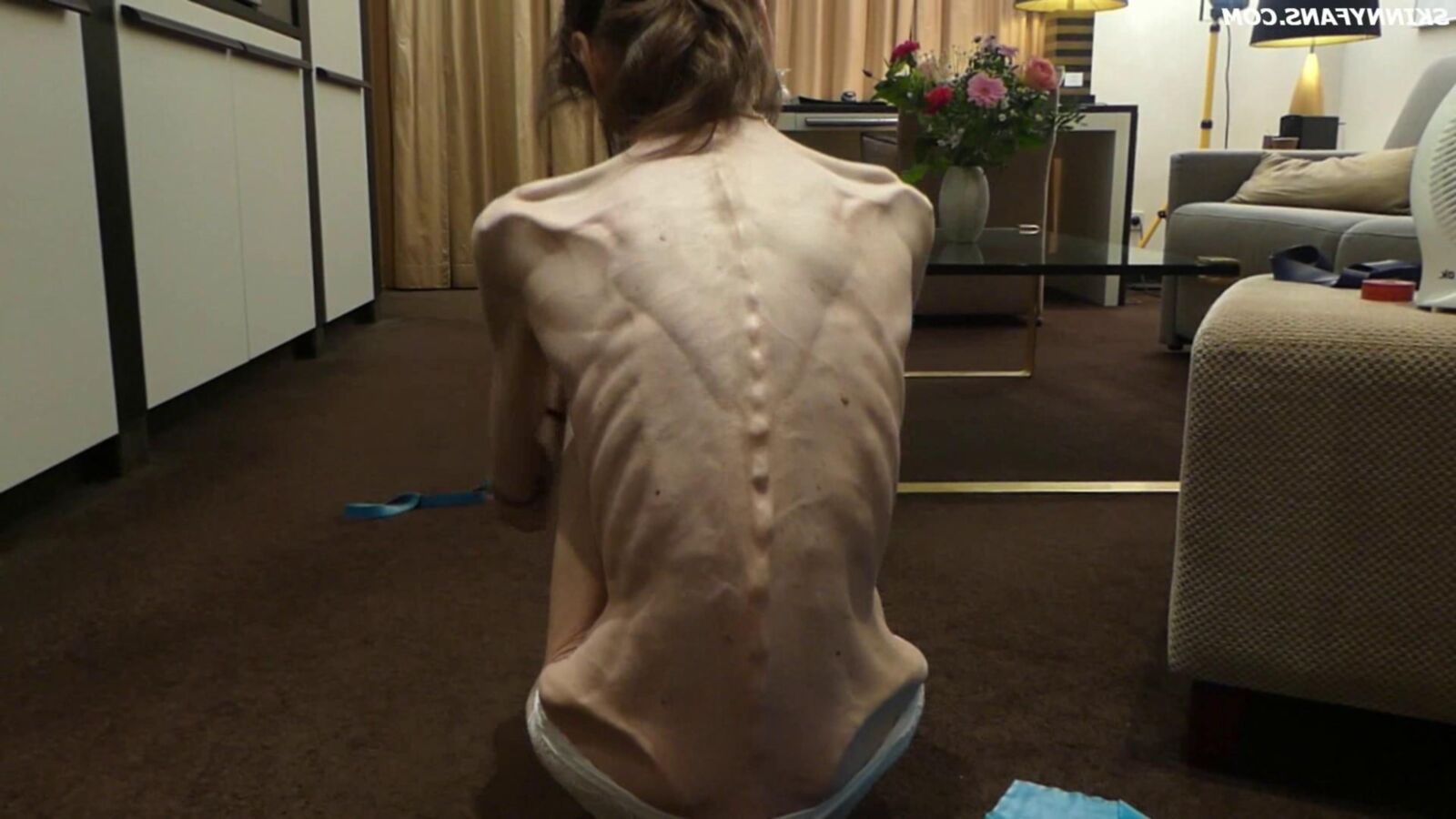 Gina anoréxica skinny frágil Mager Duenn Knochig Bones