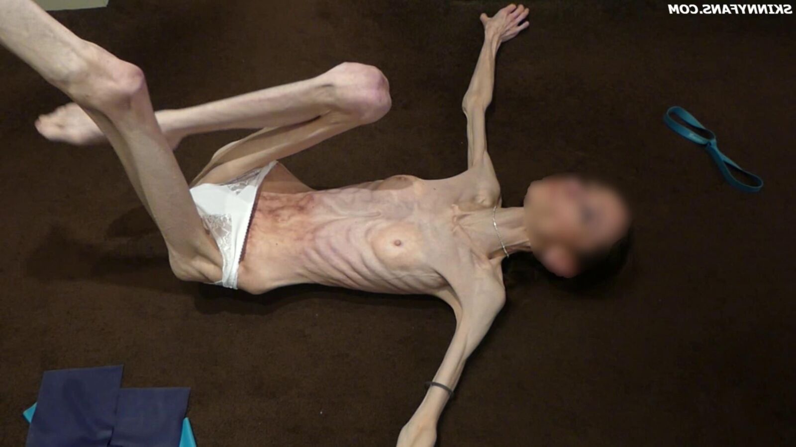 Gina anoréxica skinny frágil Mager Duenn Knochig Bones