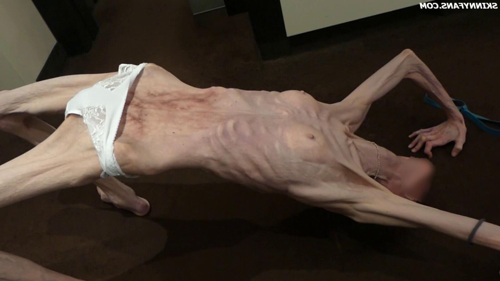 Gina anoréxica skinny frágil Mager Duenn Knochig Bones