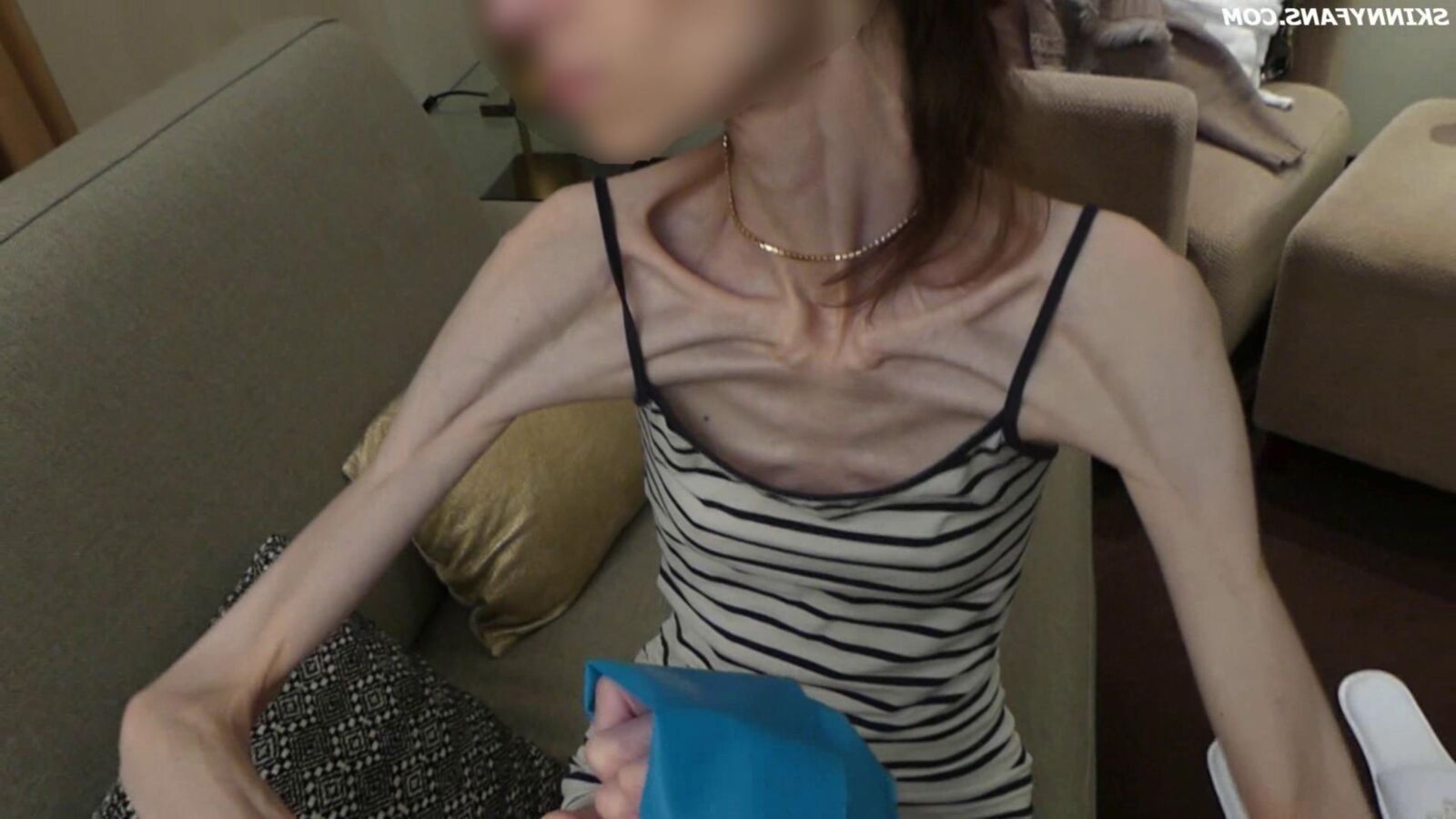 Gina anoréxica skinny frágil Mager Duenn Knochig Bones
