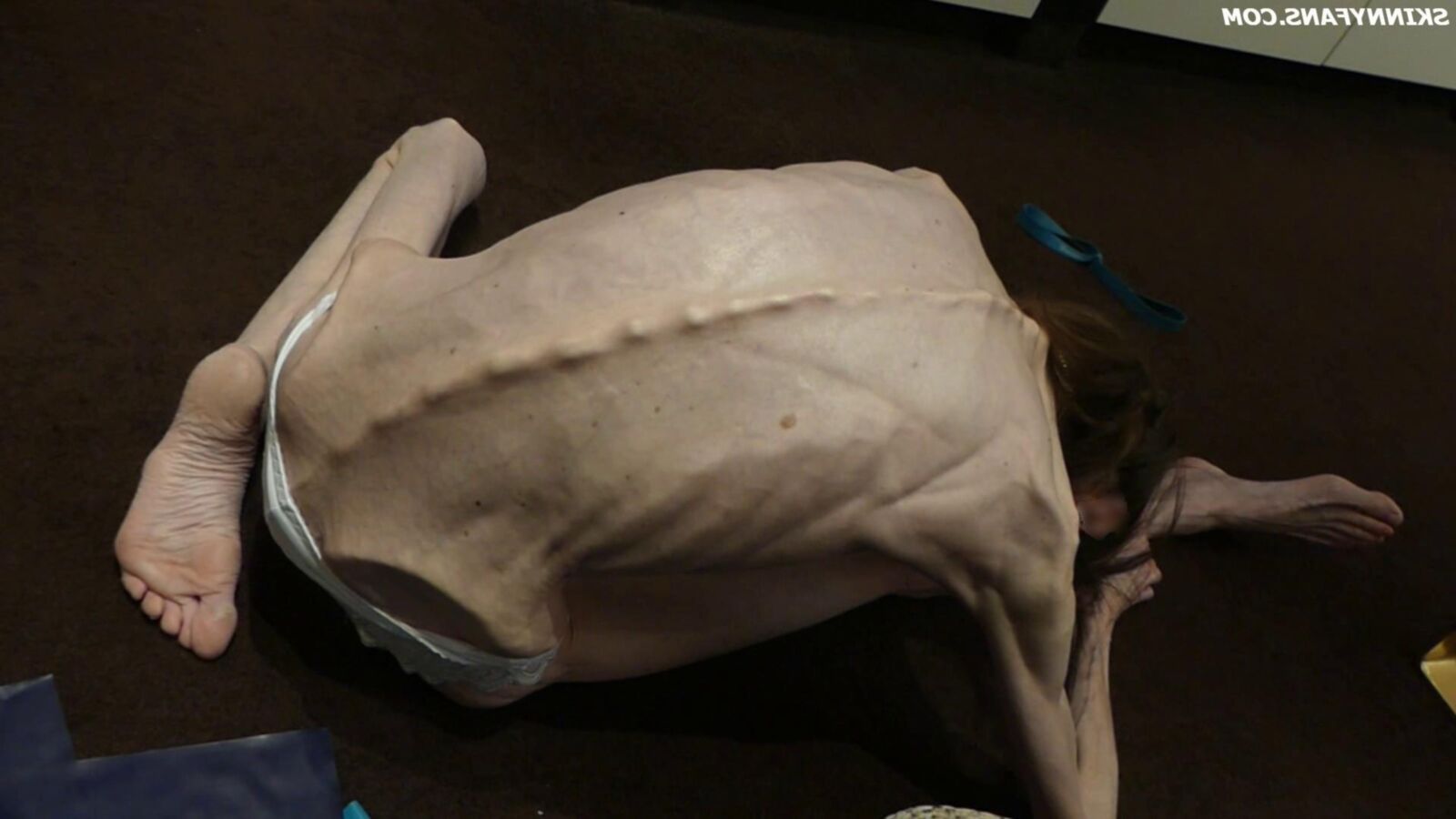 Gina anoréxica skinny frágil Mager Duenn Knochig Bones