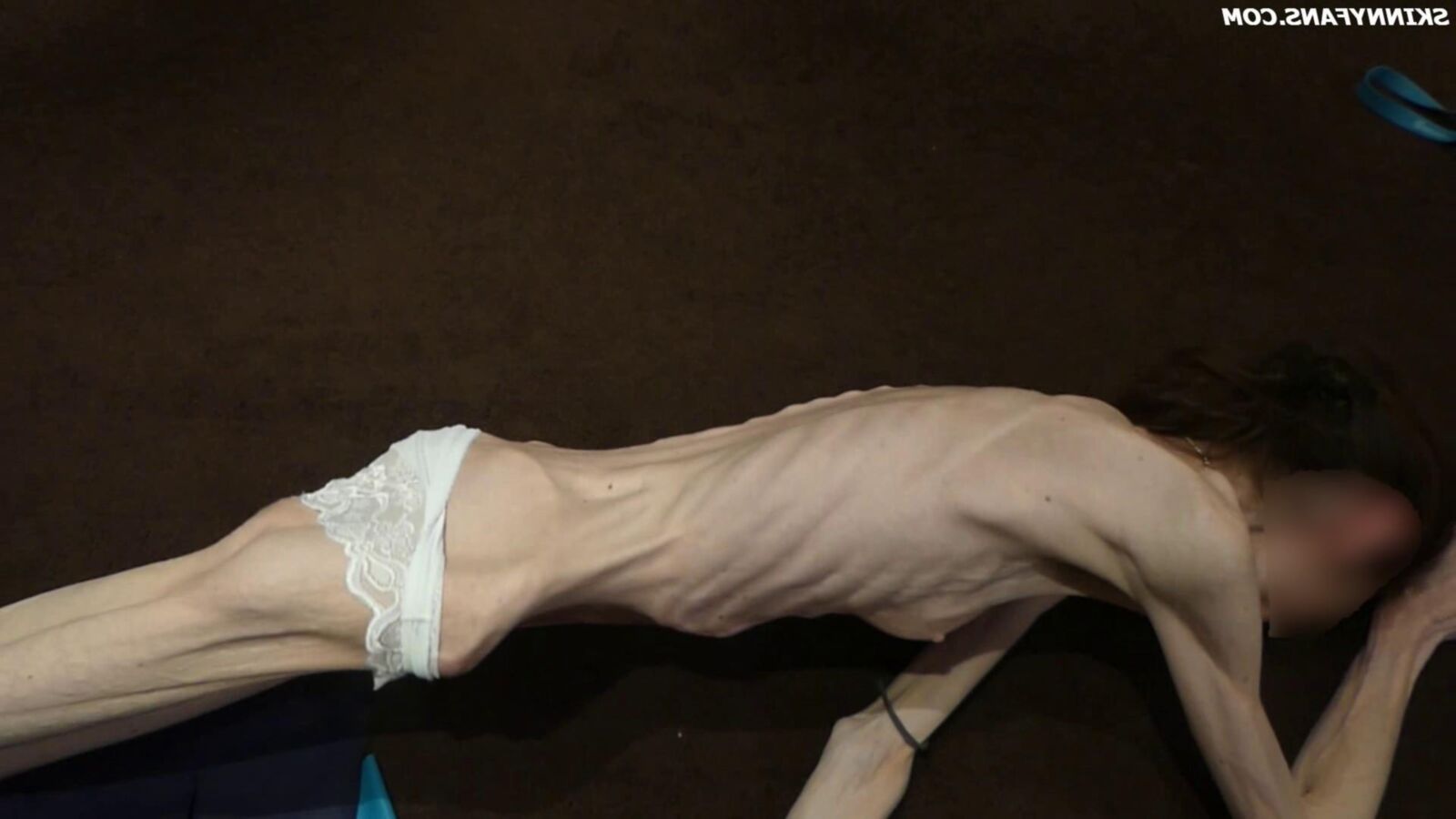 Gina anoréxica skinny frágil Mager Duenn Knochig Bones