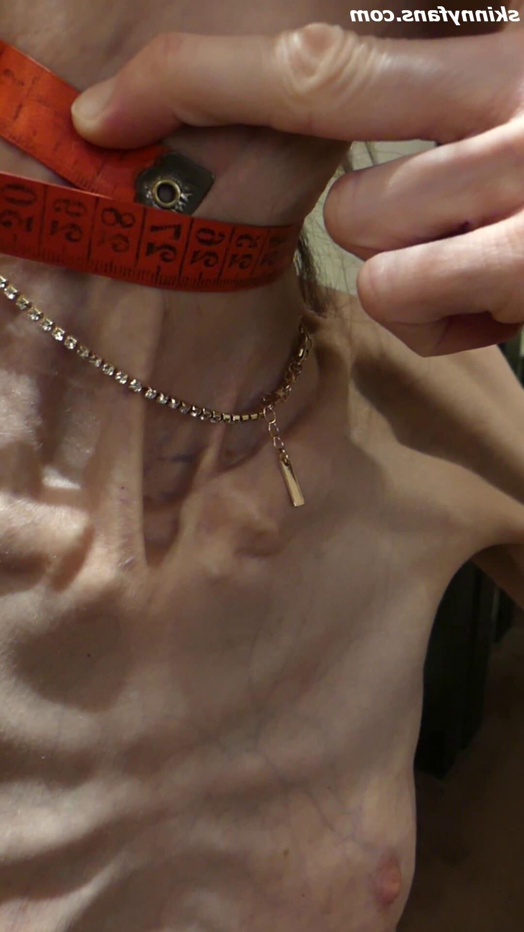 Gina anoréxica skinny frágil Mager Duenn Knochig Bones
