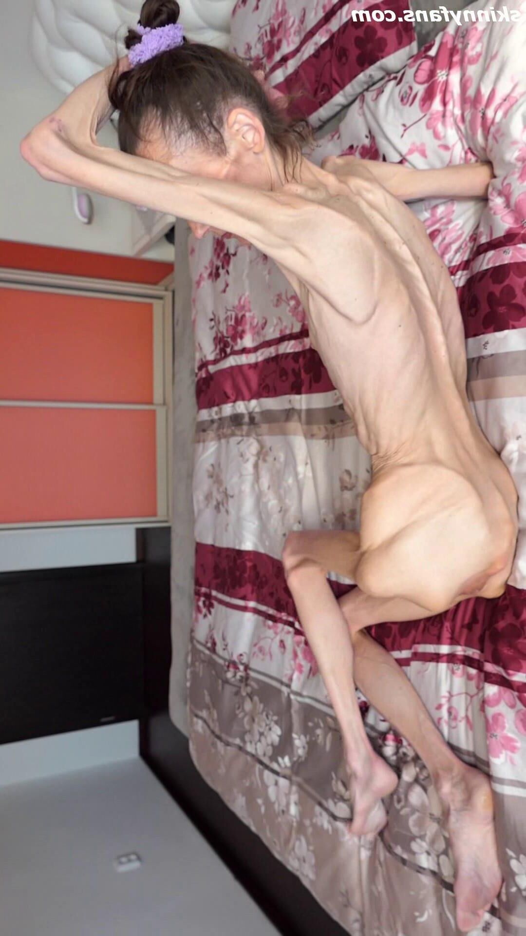 Denisa anoréxico flaco frágil mager duenn knochig huesos