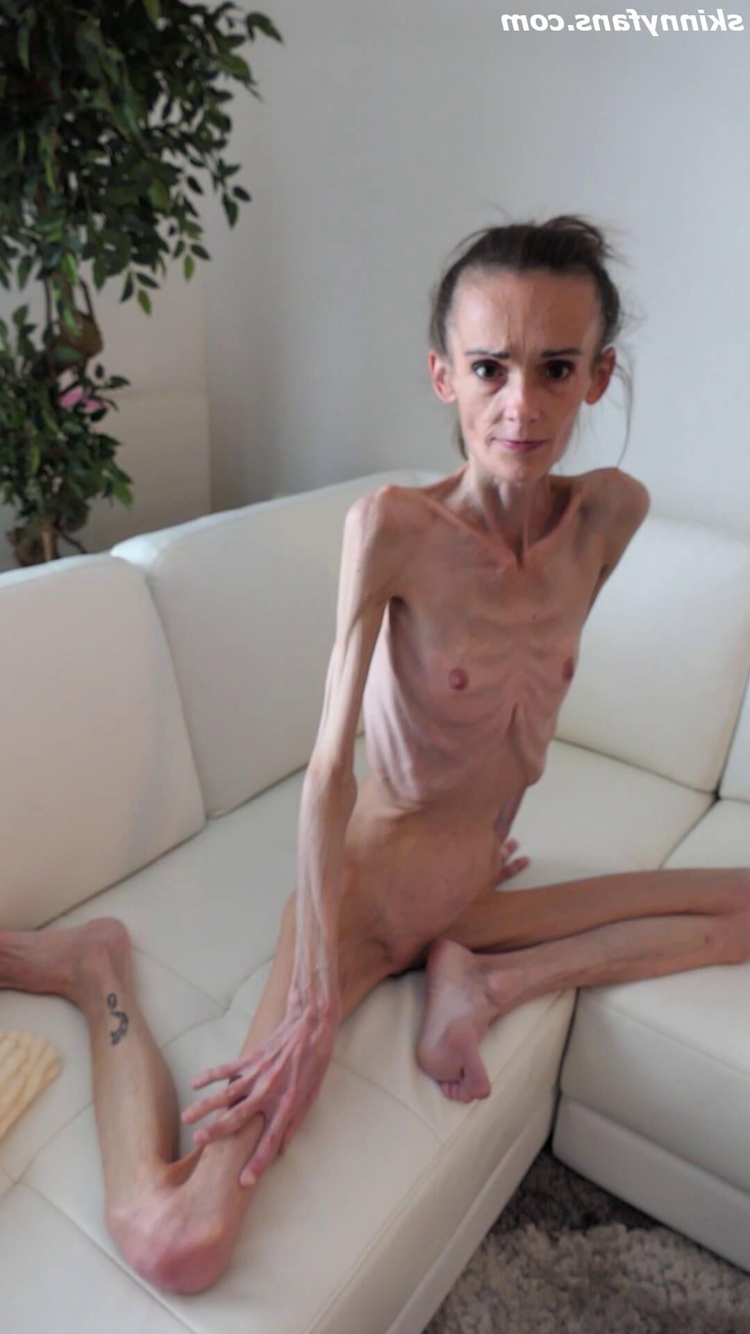 Denisa anoréxico flaco frágil mager duenn knochig huesos