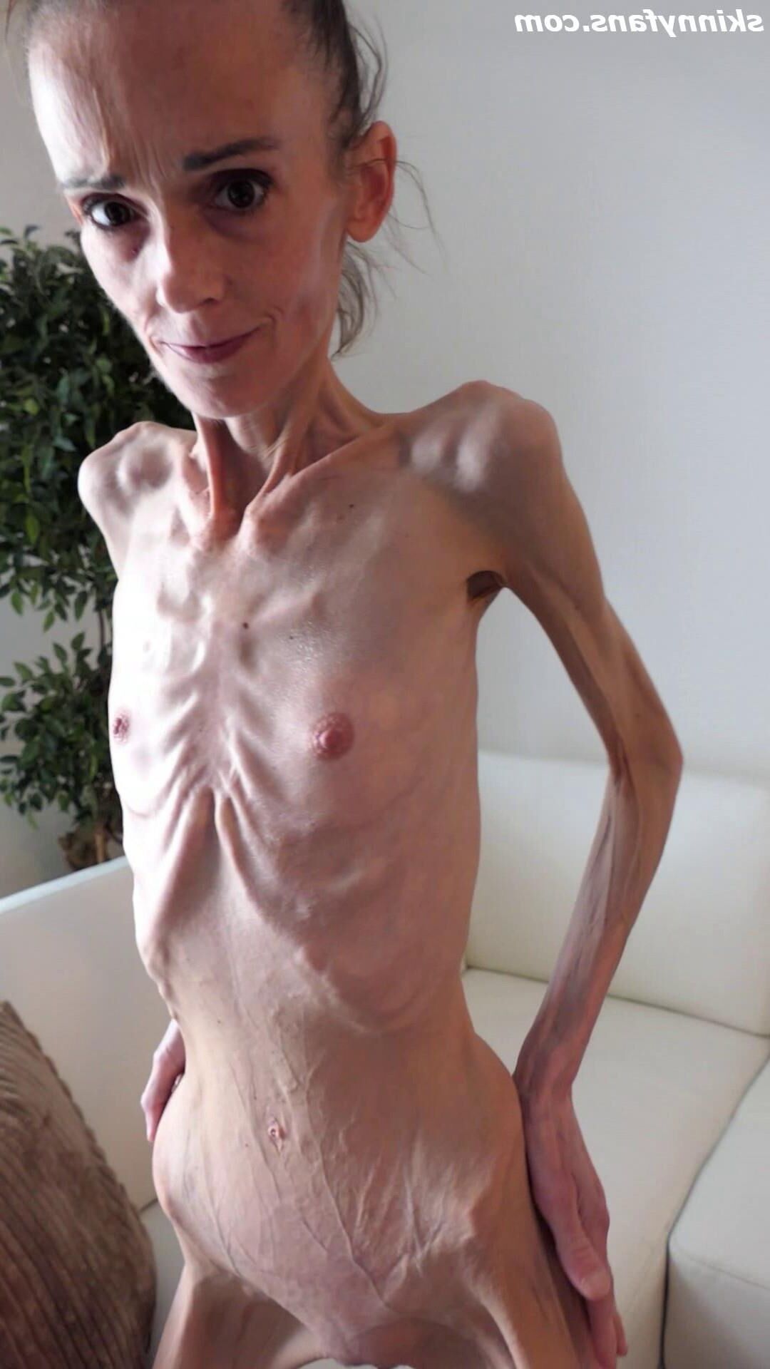 Denisa anoréxico flaco frágil mager duenn knochig huesos
