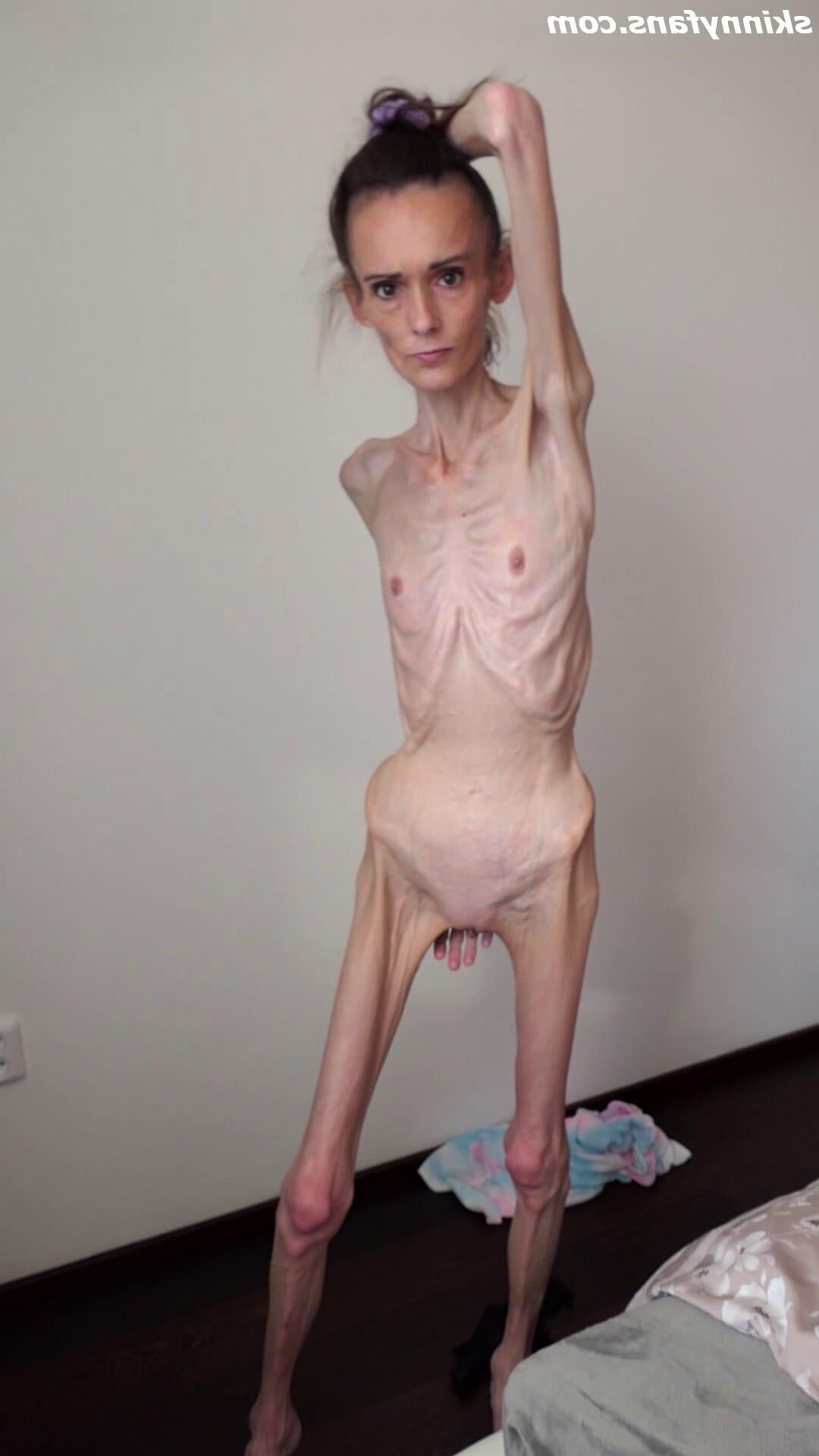 Denisa anoréxico flaco frágil mager duenn knochig huesos