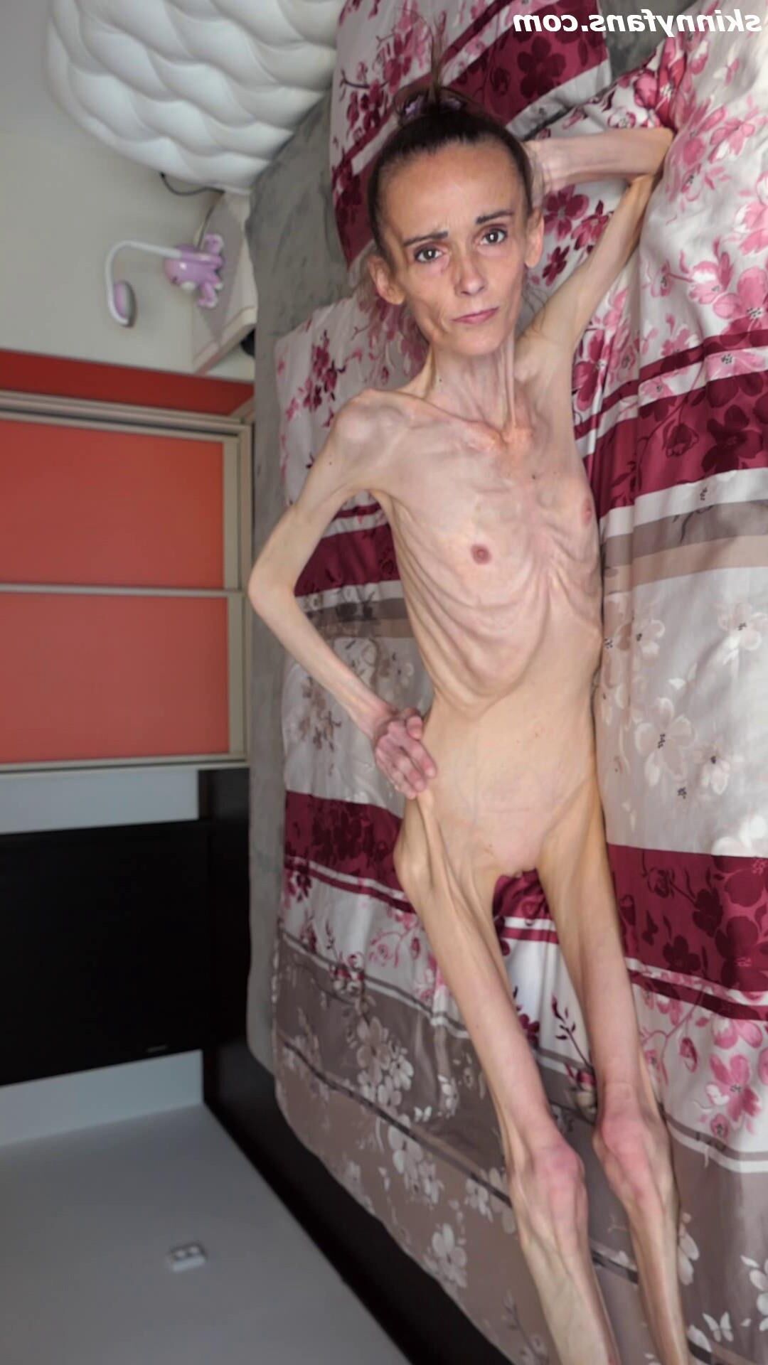 Denisa anoréxico flaco frágil mager duenn knochig huesos