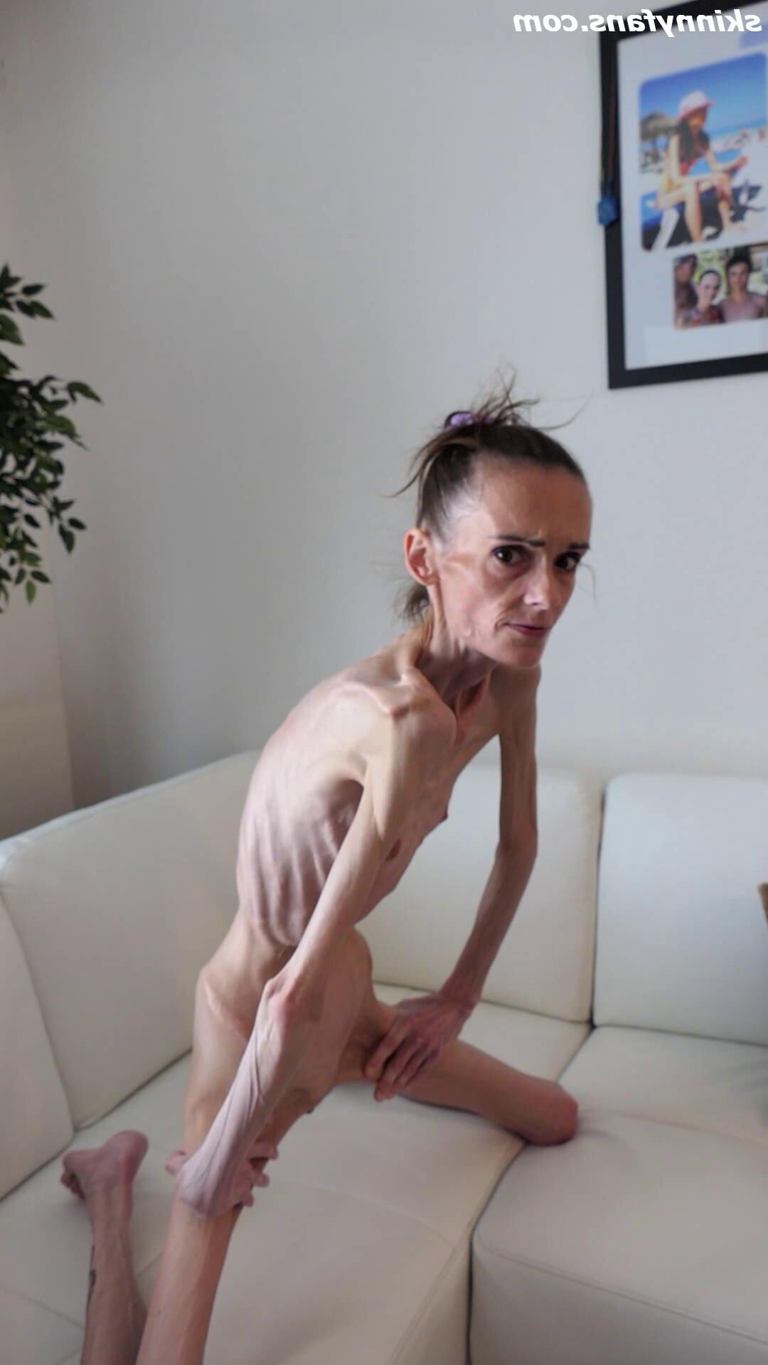 Denisa anoréxico flaco frágil mager duenn knochig huesos