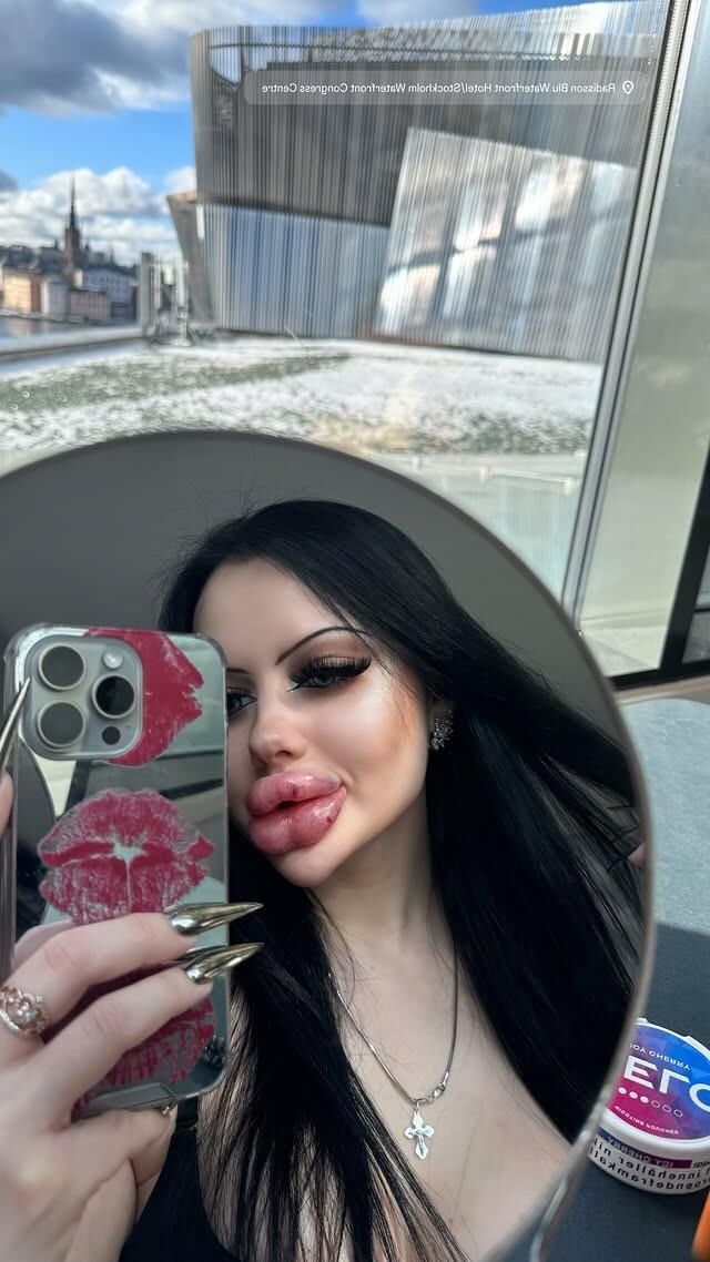 Allison