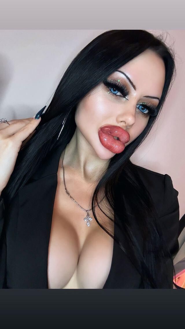 Allison