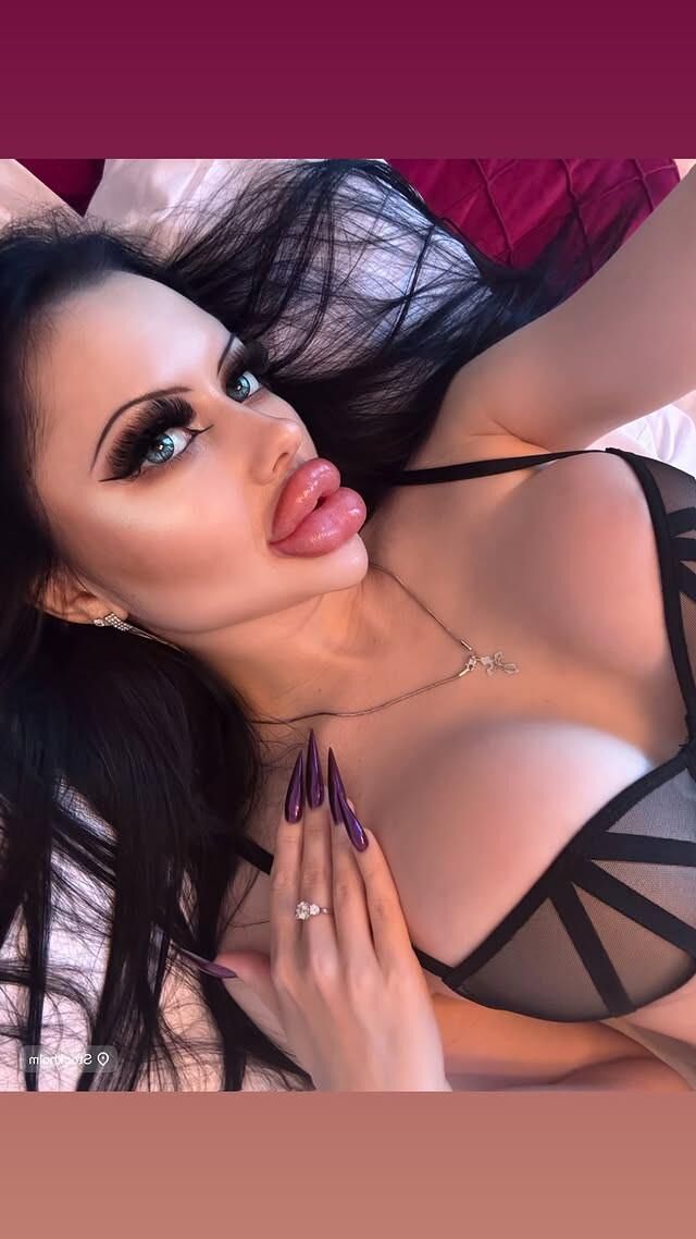 Allison