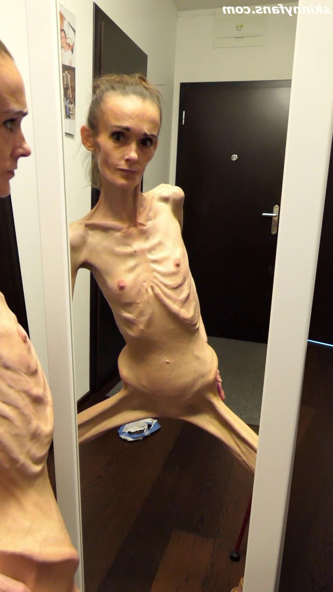 Denisa magersüchtig