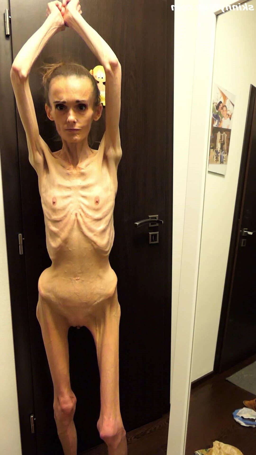 Denisa magersüchtig