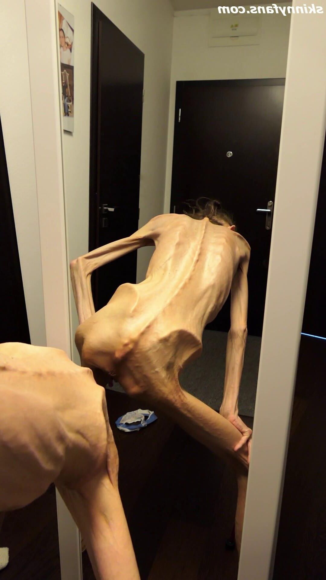 Denisa magersüchtig