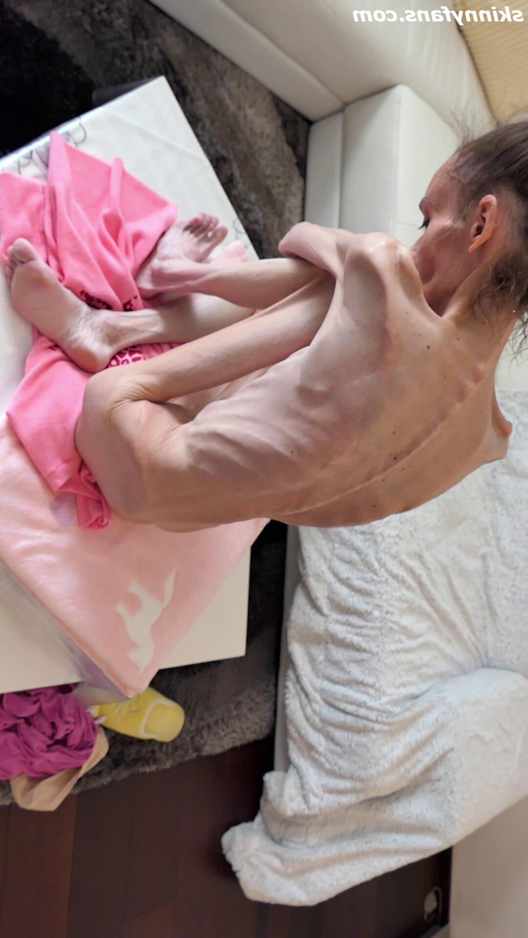 Denisa anorexic skinny fragile mager duenn knochig bones 