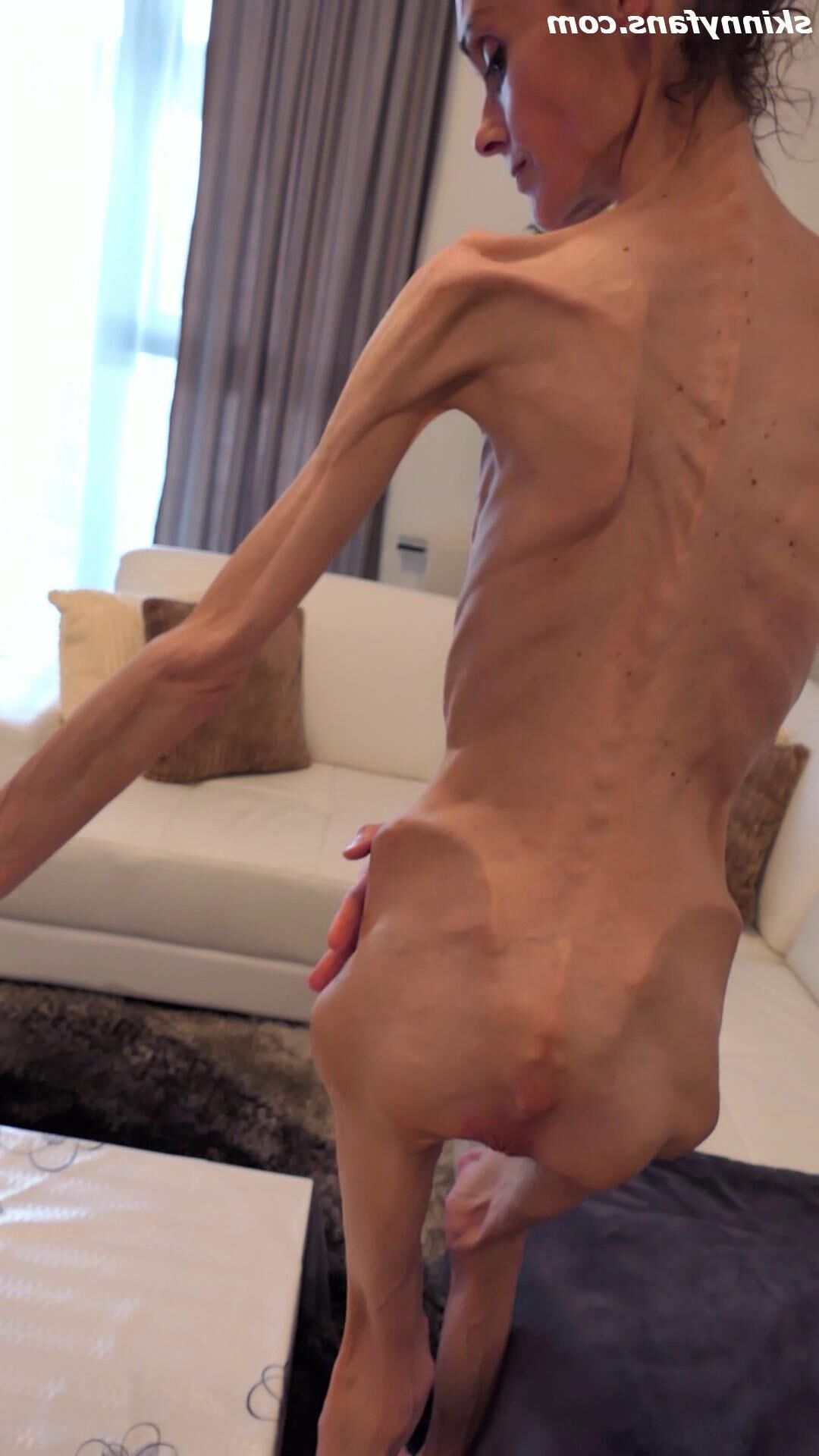 Denisa anorexic skinny fragile mager duenn knochig bones 