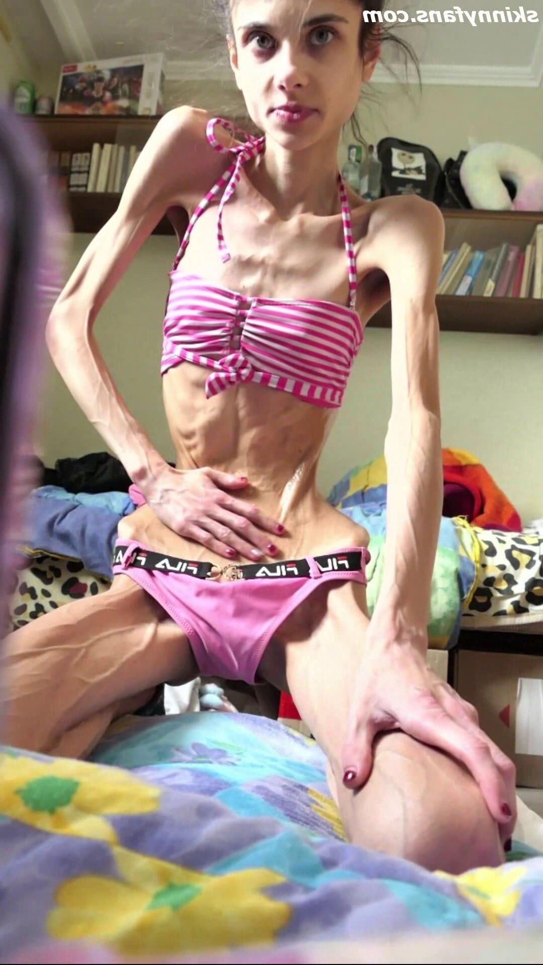 Ariadne anorexic skinny fragile mager duenn knochig bones 
