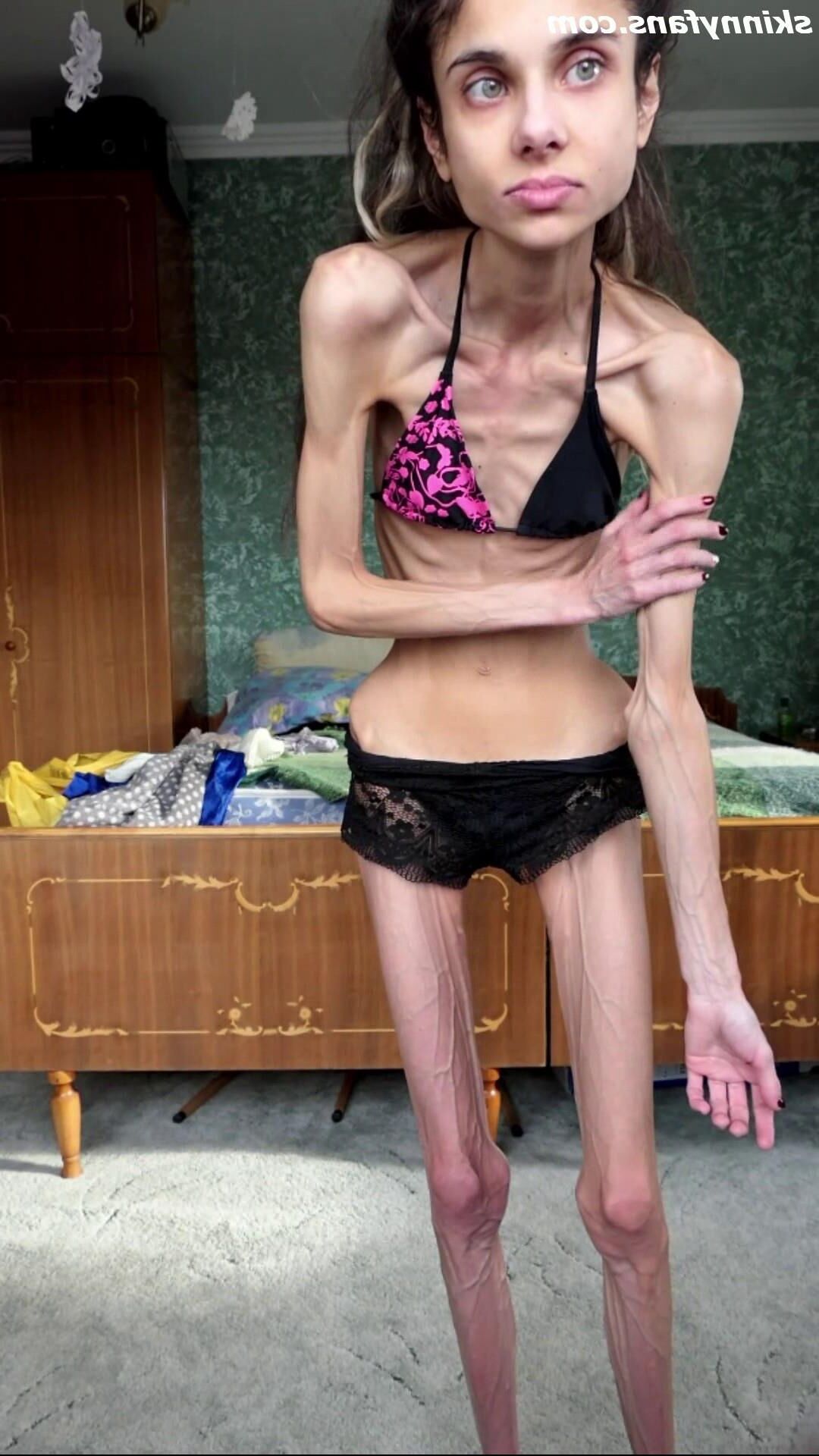Ariadne anorexic skinny fragile mager duenn knochig bones 