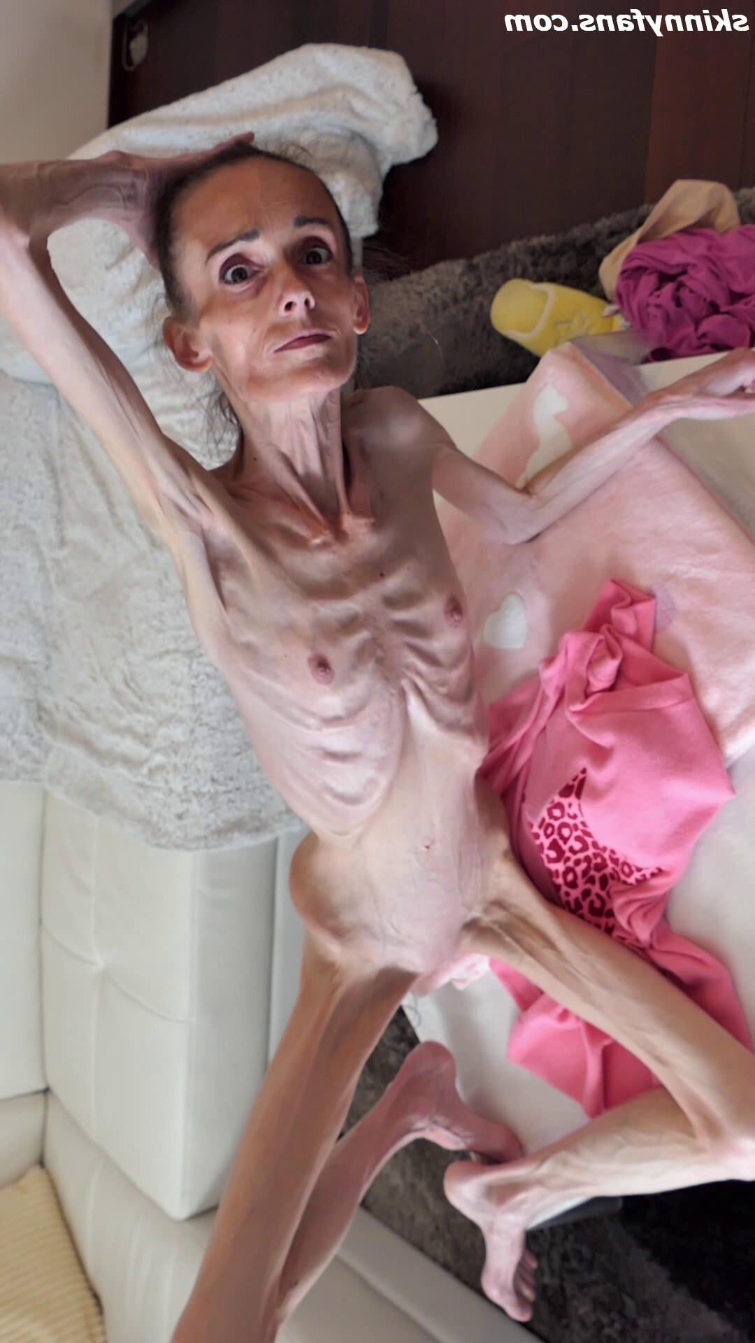 Denisa anorexic skinny fragile mager duenn knochig bones 