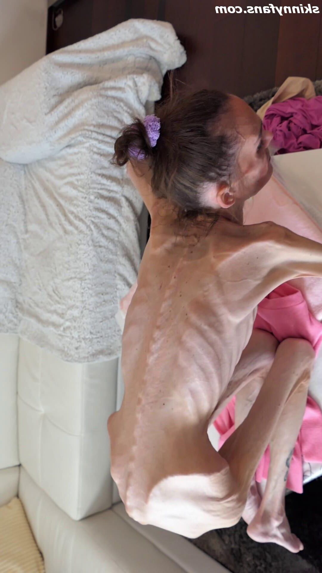 Denisa anorexic skinny fragile mager duenn knochig bones 
