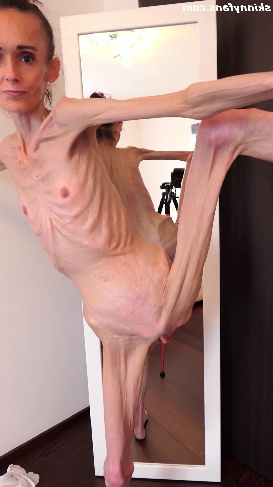 Denisa anorexic skinny fragile mager duenn knochig bones 