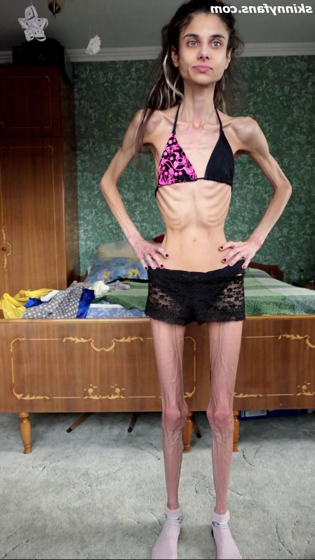 Ariadne anorexic skinny fragile mager duenn knochig bones 