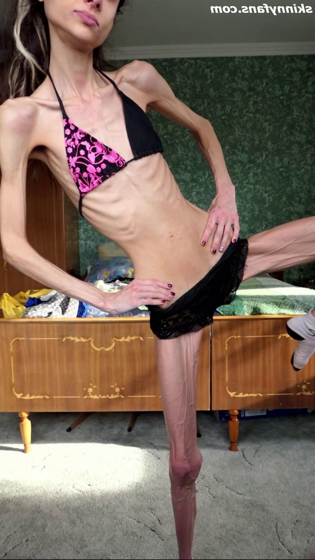 Ariadne anorexic skinny fragile mager duenn knochig bones 