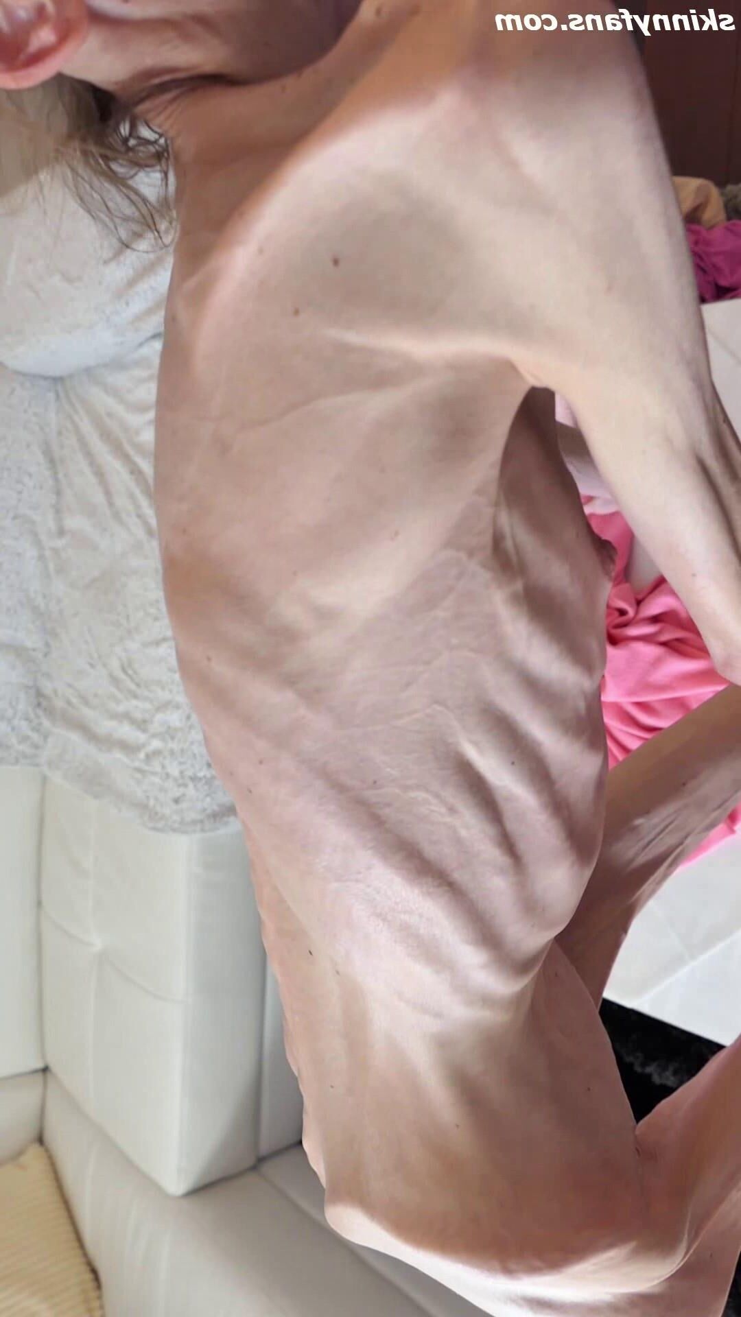 Denisa anorexic skinny fragile mager duenn knochig bones 