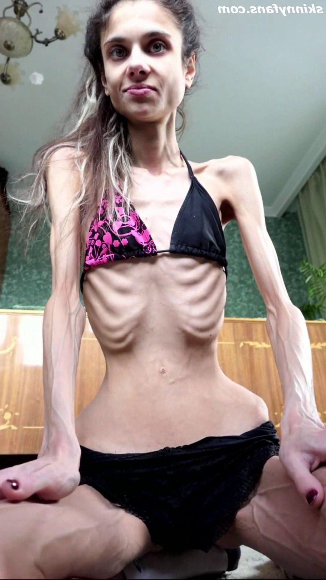 Ariadne anorexic skinny fragile mager duenn knochig bones 
