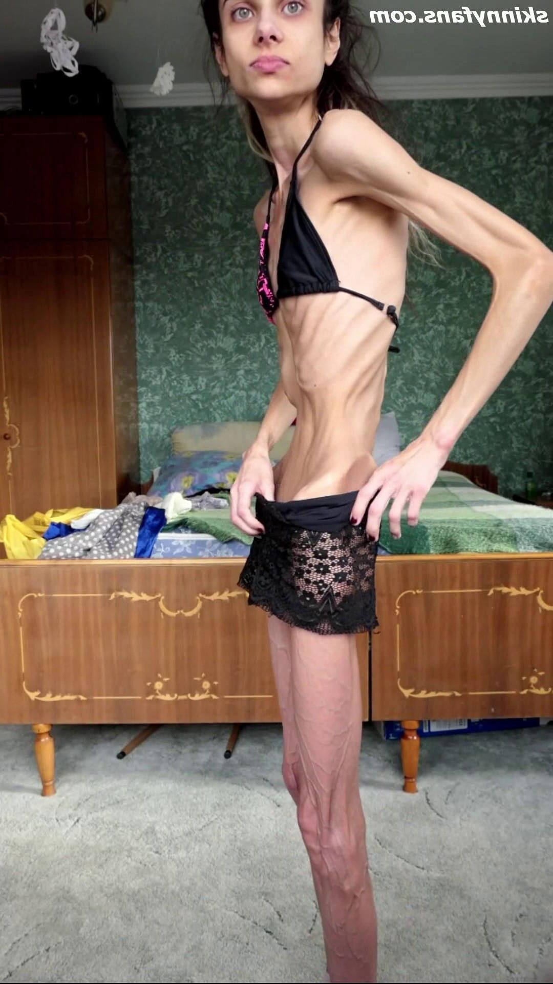 Ariadne anorexic skinny fragile mager duenn knochig bones 